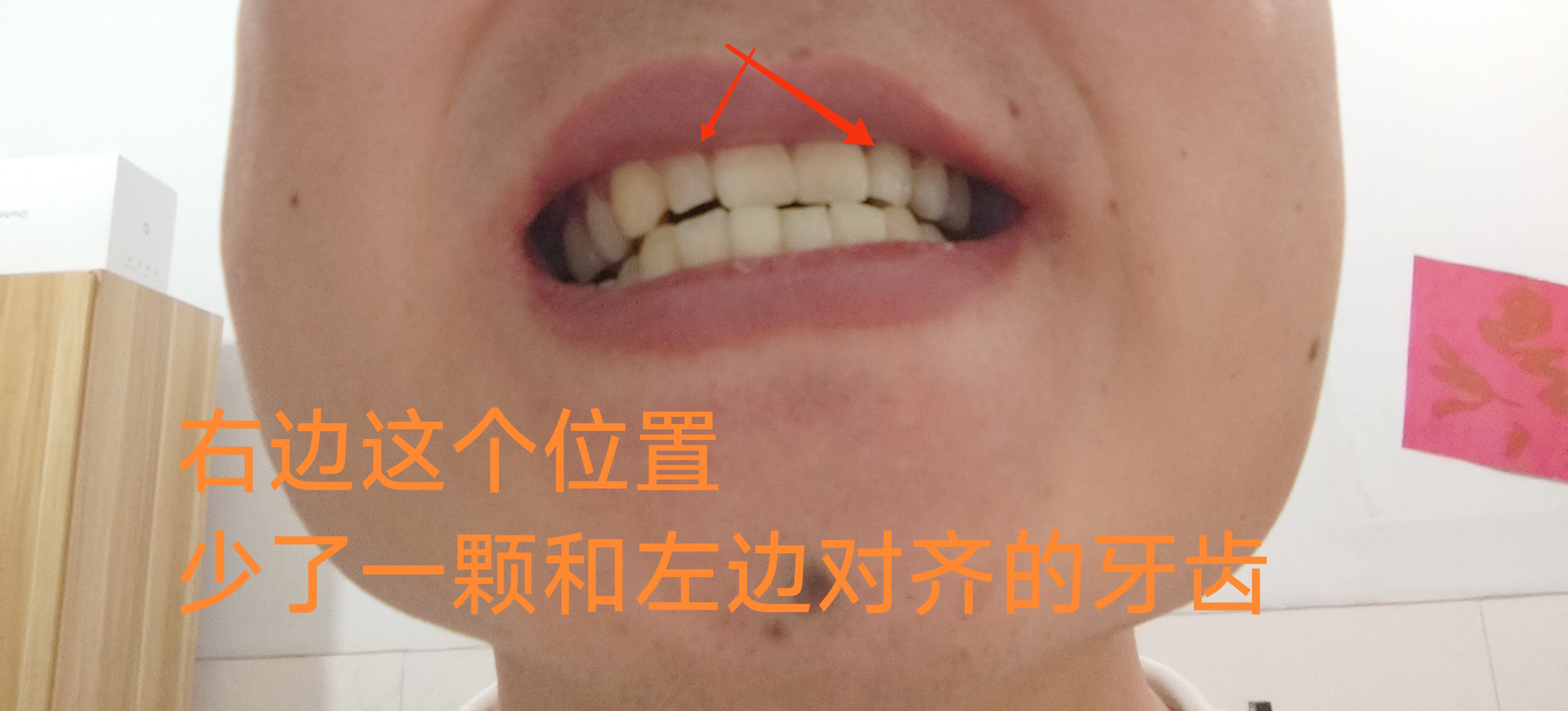 少了一颗牙加字的.jpg